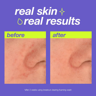 Breakout Clearing Foaming Wash