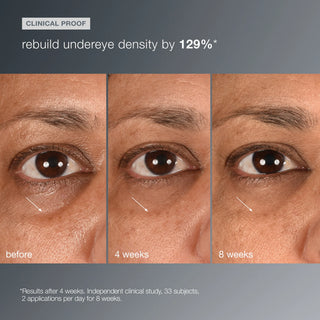 Smart Eye Density Undereye Serum